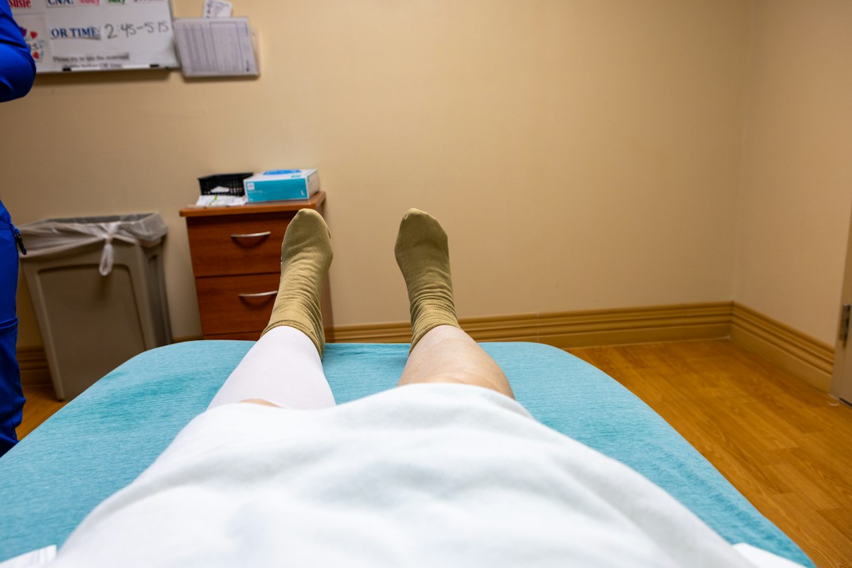 Inflamación y edema en las extremidades inferiores